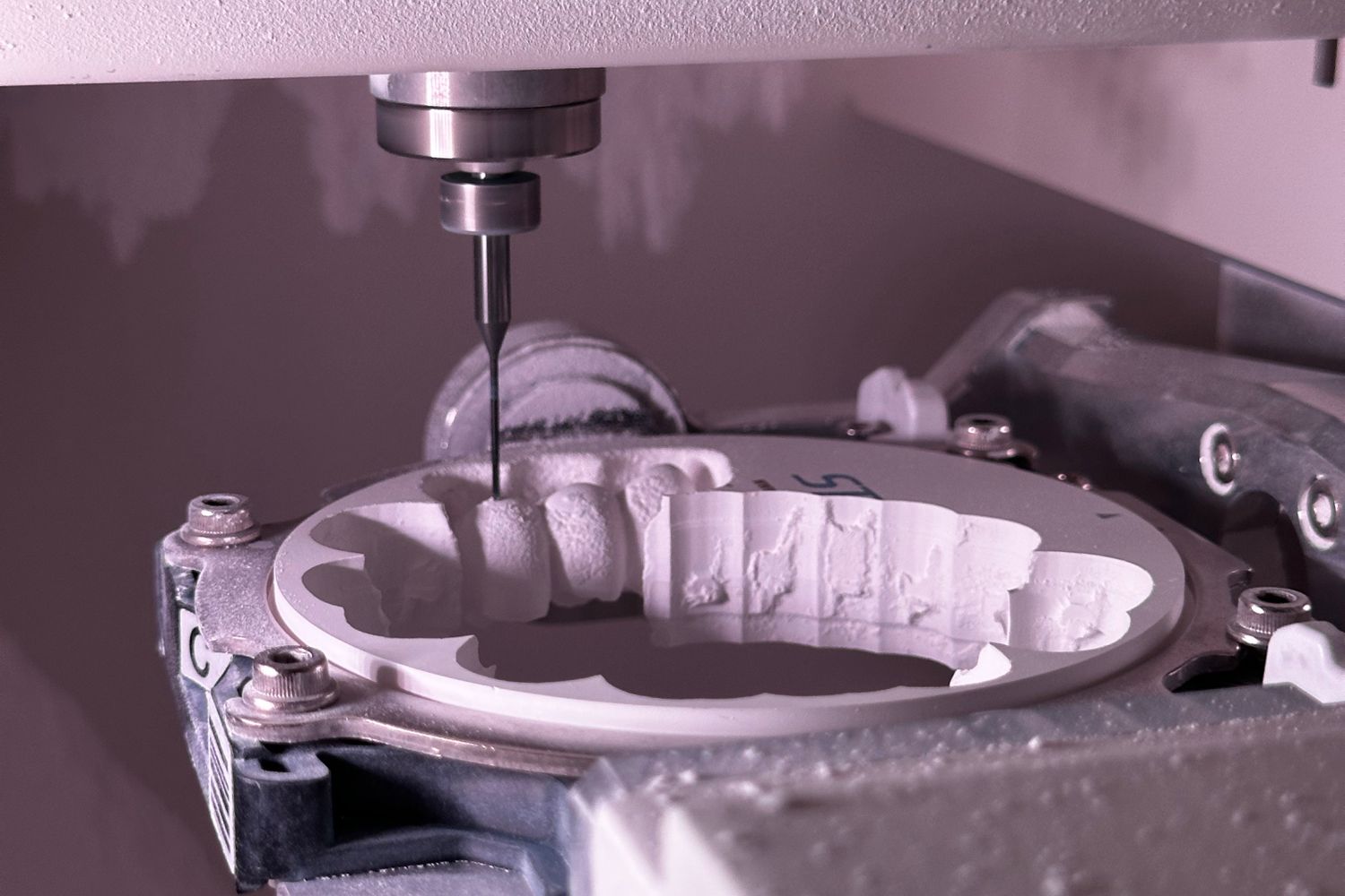 Máquina CEREC fresando corona dental en porcelana - OdontologíaMD